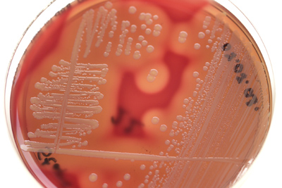 Hält fast allen Antibiotika stand: Bakterienkultur mit multiresistentem Staphylococcus aureus (MRSA).