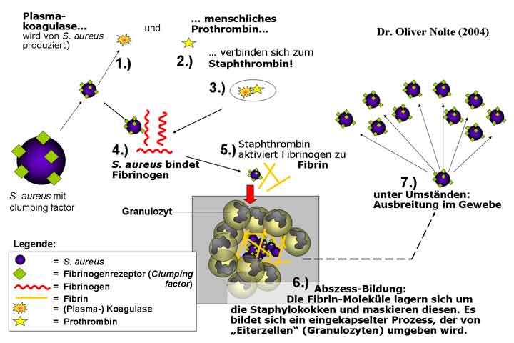 Zusammenwirken von S. aureus spezifischen Pathogenitätsfaktoren wie Koagulase und clumping factor mit Wirt-eigenen Faktoren in der Entstehung von Furunkeln und Abszessen
